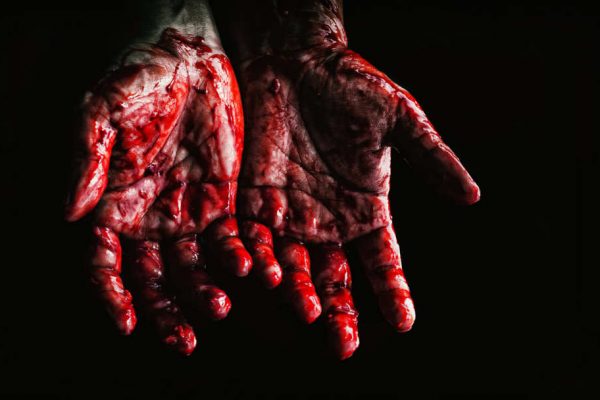 Hands covered in blood