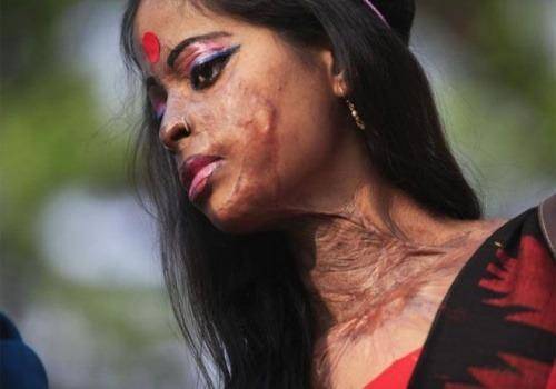 acid survivor