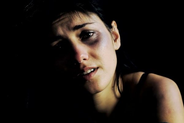 woman victim of physical abuse