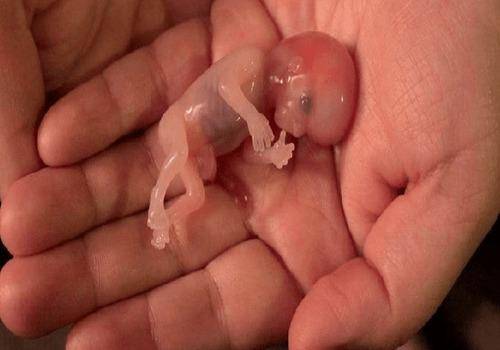Abortion laws in India help rape survivors and people with unwanted pregnancies Abortion laws in India help rape survivors and people with unwanted pregnancies