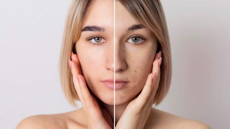 what is the best dark spot remover for face